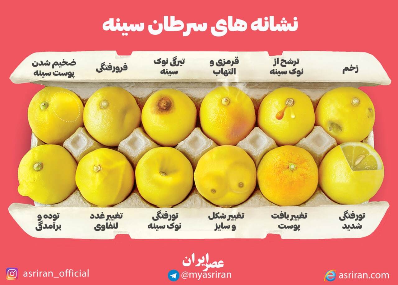 نشانه های سرطان سینه (اینفوگرافیک)