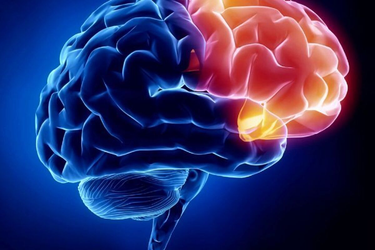 شناسایی ۱۸۵ نوع بیماری نادرِ مغز و اعصاب