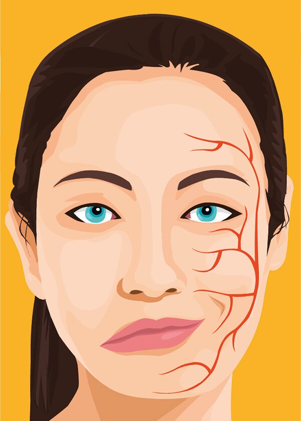 اسپاسم نیمه صورت؛ اختلالی شایع در زنان بالای 40 سال!