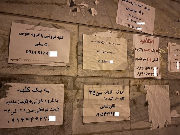 عضو بدن شما را خریداریم! / فروش دلاری کلیه با سفر ایرانی ها به ترکیه و عراق