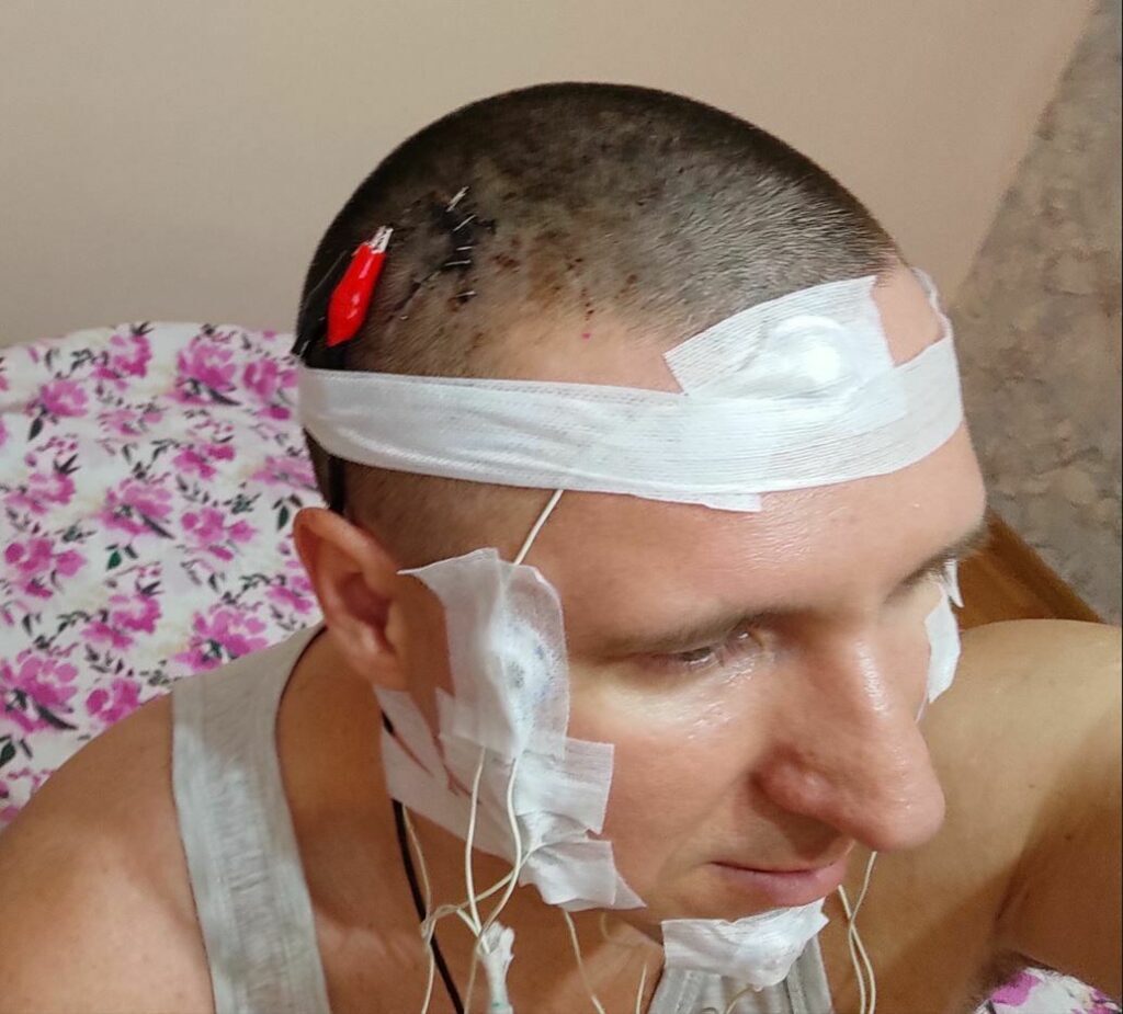 کنترل رؤیا با ایمپلنت مغزی / محقق روس با دریل جمجمه‌اش را سوراخ کرد و در مغزش تراشه کاشت!
