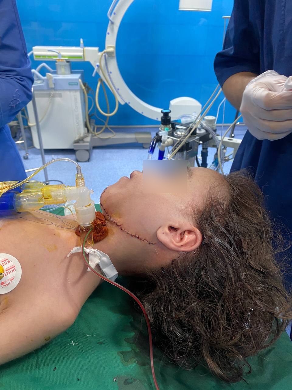 شاهکار پزشکان ایرانی: جراحی منحصر به فرد دختر 11 ساله در بیمارستان مفید (+عکس +16)