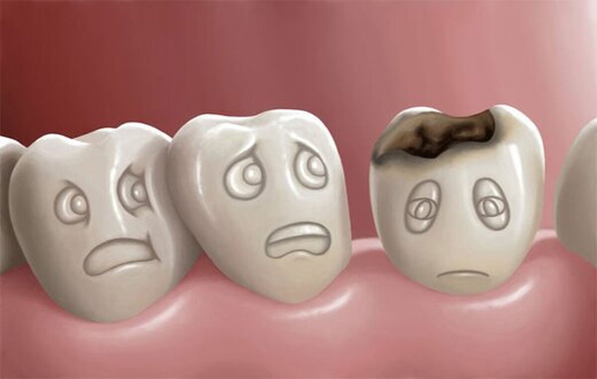 دندانپزشکی : نرخ های نجومی، جیب های خالی/ ۱۰۰ میلیون برای بازسازی دندان‌ !