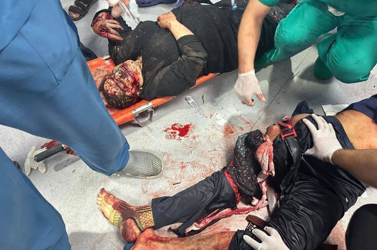 کشته ها و زخمی های بمباران بیمارستان المعدانی در غزه