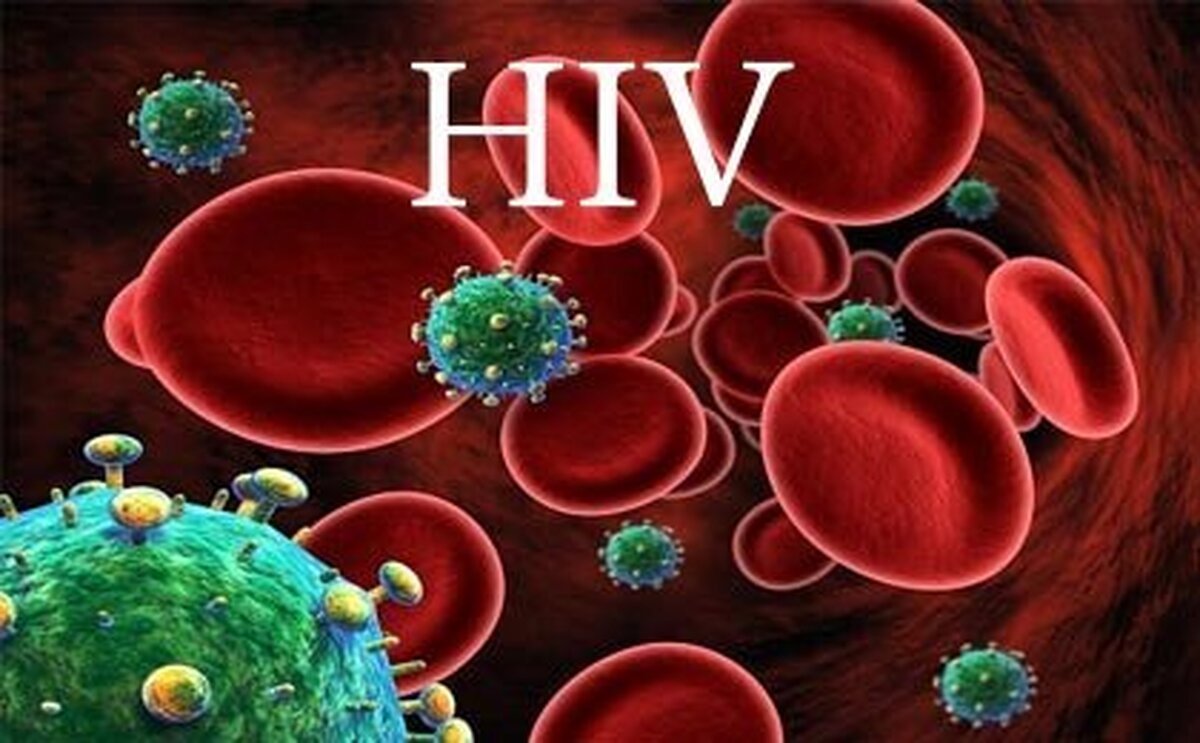 درمان رایگان و محرمانه ایدز ( HIV ) در کشور/ ضرورت گسترش تست‌های خودآزمایی