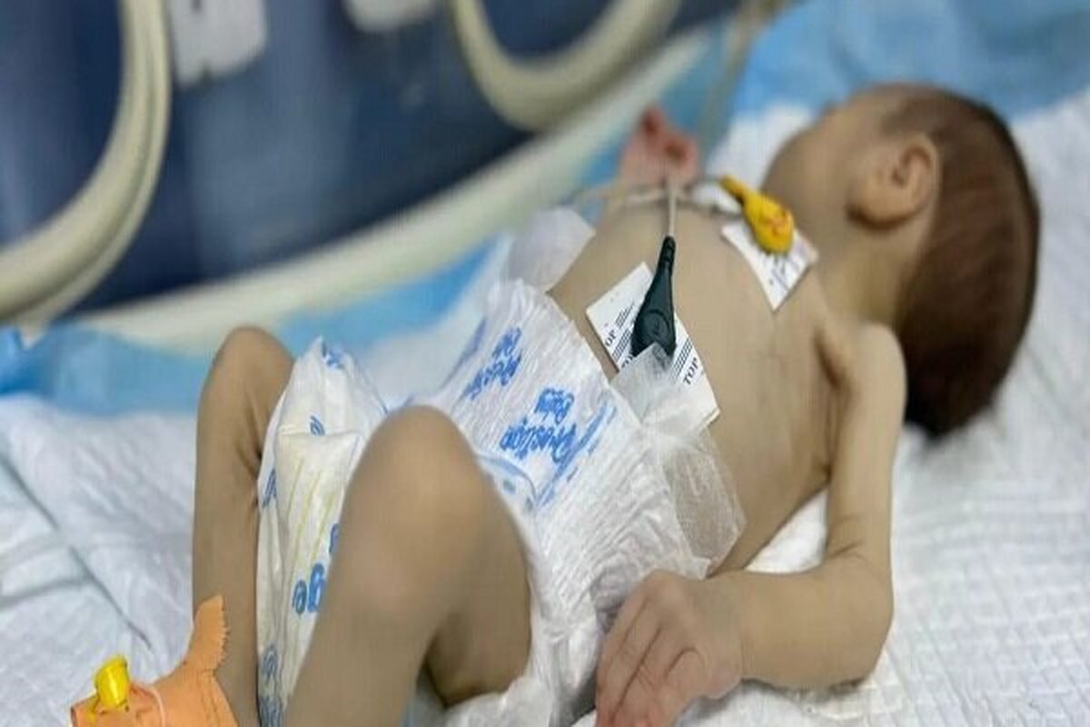 نوزاد شیرخواره غزه‌ای که با مرگ دست و پنجه نرم می‌کند
