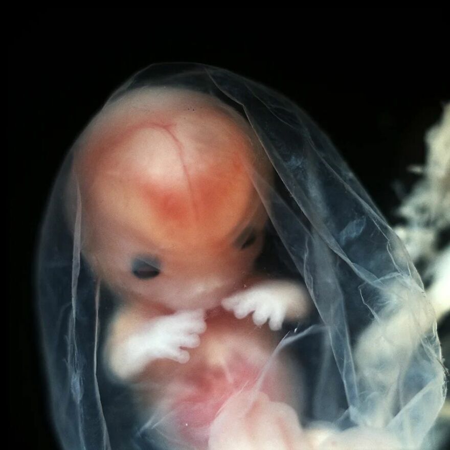 جنین(Embryo) در ۸ هفتگی