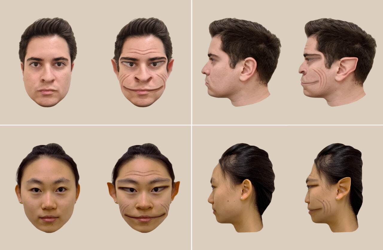 بیماری نادری که باعث می‌شود چهره افراد را شبیه به فیلترهای «تیک‌تاک» ببینید! (+عکس)