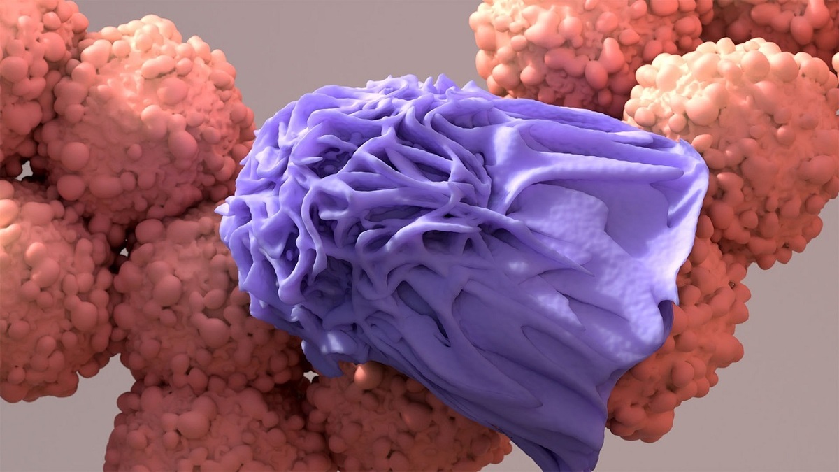 چگونه سلول های سرطانی را از بین ببریم؟ (فیلم)