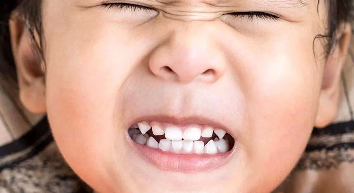 ۳ علامت پنهان دندان‌قروچه که شاید از آن بی‌خبر باشید