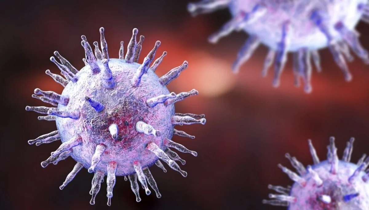 مطالعه: ویروس رایج بوسه ممکن است باعث ابتلا به لوپوس شود