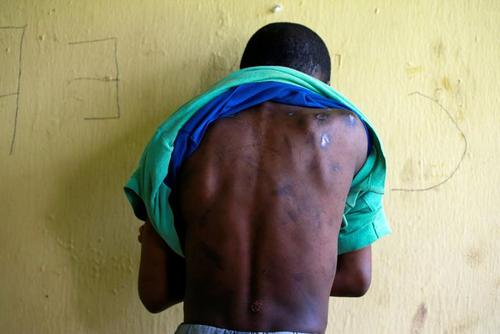 آثار ضرب و جرح و شکنجه بر تن شهروندان نیجریه‌ای که از یک مرکز شکنجه در شهر 