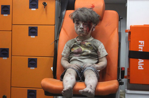 پسر بچه‌ای در حمله هوایی حلب ۲۰۱۶ 