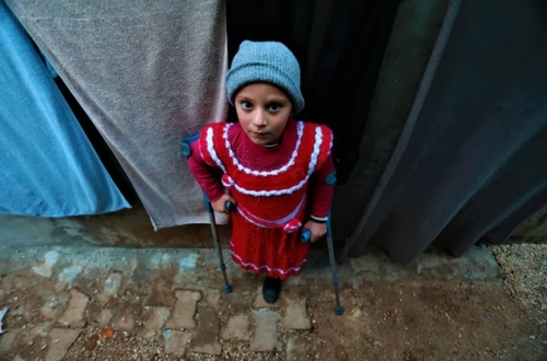 دختر 6 ساله سوری که یک پای خود را در جنگ داخلی این کشور از دست داده است/استان ادلب/ خبرگزاری آناتولی