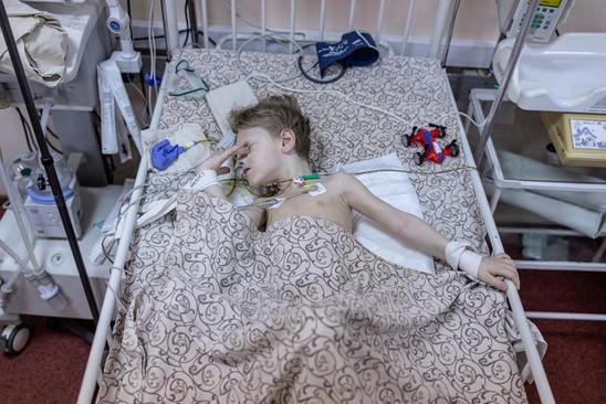 زخمی شدن کودک 3 ساله اوکراینی در حمله موشکی روسیه به شهر 
