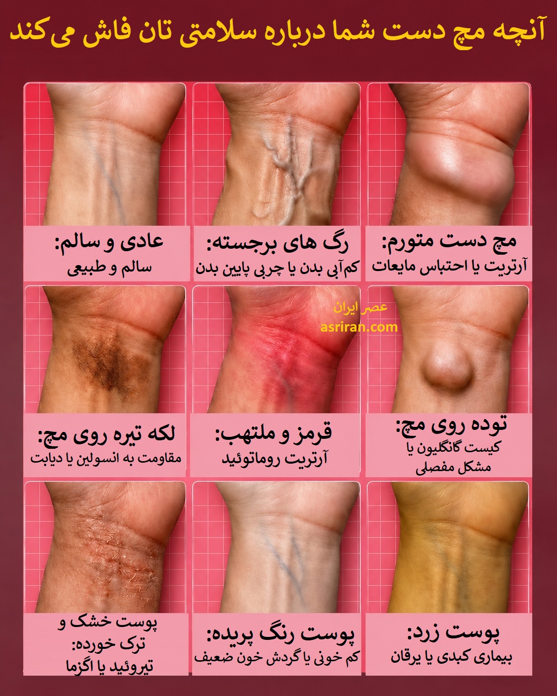 اینفوگرافیک رازهایی که مچ دست درباره سلامت شما فاش می کند اینفوگرافیک رازهایی که مچ دست درباره سلامت شما فاش می کند