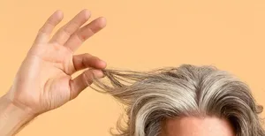 سفید شدن مو در دهه‌ی بیست زندگی؟