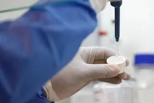 یک اپیدمیولوژیست: مسافران ورودی از روسیه برای پیشگیری از طاعون باید غربالگری شوند