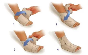 اقدامات اولیه در پیچ‌خوردگی مچ پا در پیاده‌روی اربعین