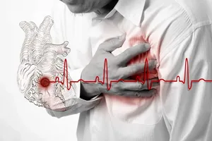 سکته قلبی و مغزی؛ عامل مرگ نزدیک به نیمی از ایرانی‌ها