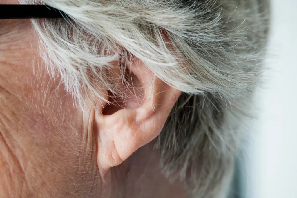 چین روی لاله گوش
