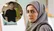 بیتا سحرخیز بازیگر ترانه مادری در تبلیغ یک کلینیک زیبایی (+عکس)
