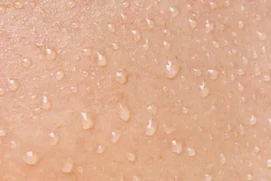 عرق چه تاثیری بر سلامت پوست دارد؟