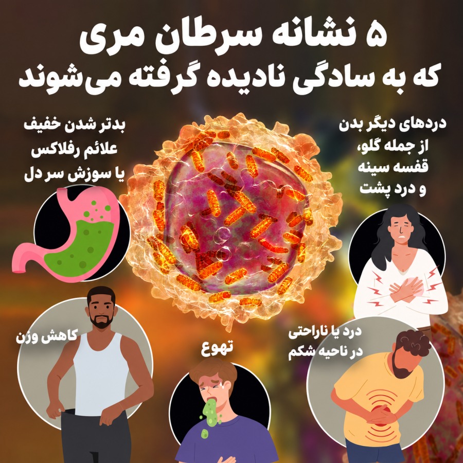 سرطان مری