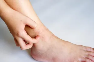 خارش قوزک پا؛ علت چیست